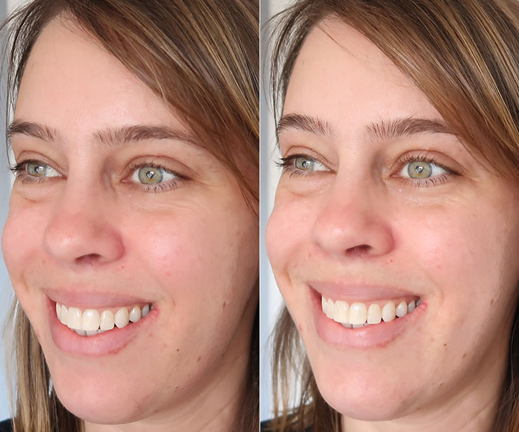 Óleo Facial de vitamina c