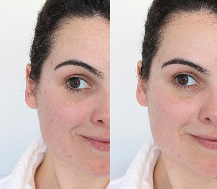 Óleo Facial de vitamina c