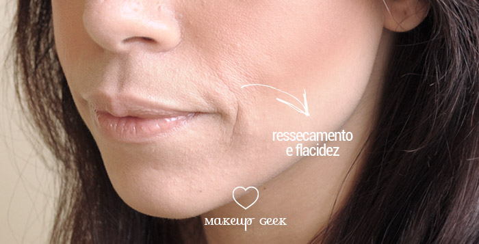 Ressecamento da Pele e Flacidez