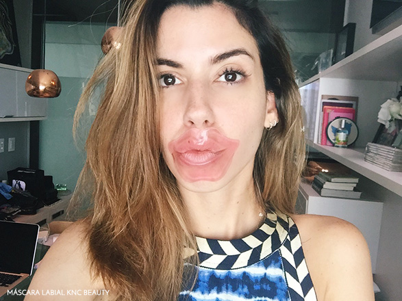 kncbeautycolagenolabios