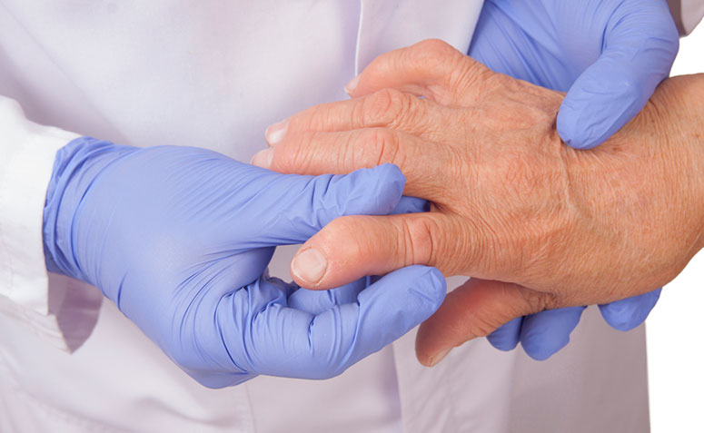 Artrose: médico fala das causas, sintomas, prevenção e tratamentos 4