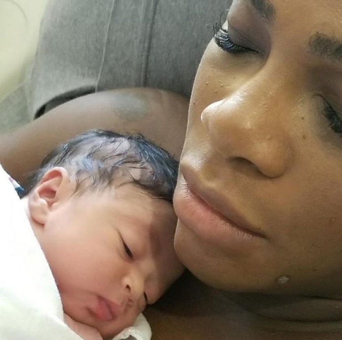 Tenista Serena Williams conta sobre complicações no parto e incentiva mulheres negras a compartilhar histórias 1 Serena após o nascimento da filha (Crédito: Instagram)
