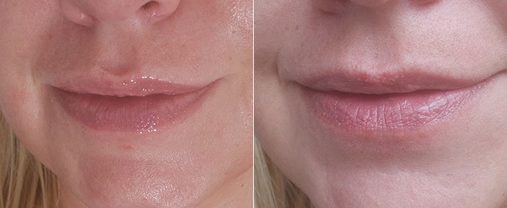 Lip Sleeping Mask da Laneige: máscara noturna para os lábios 3 laneige
